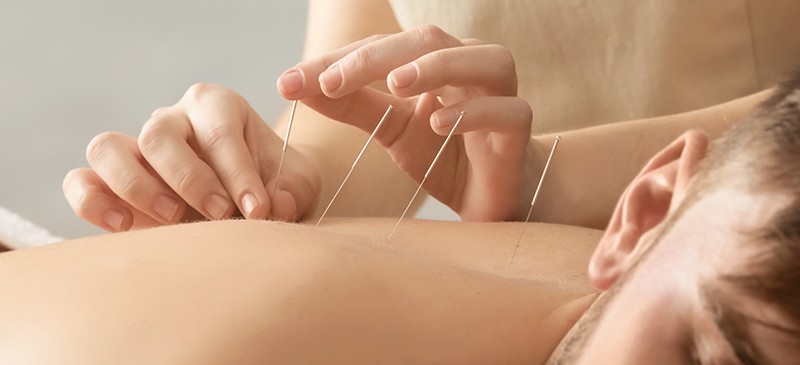 Acupuncture Therapy Brisbane