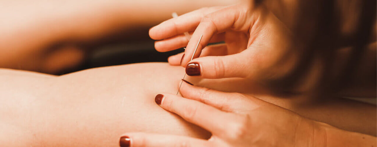 Dry Needling Brisbane